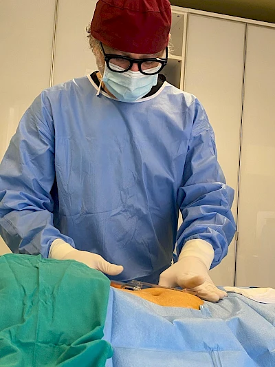 Metodo Integra: Liposuzione, cosa bisogna sapere