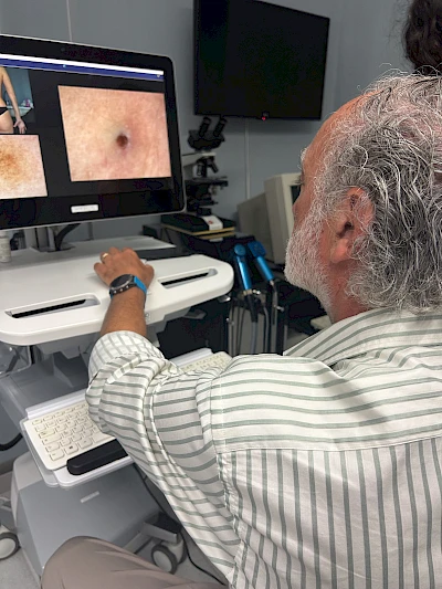Dermatologia: Melanoma,  prevenzione, diagnosi e controllo.