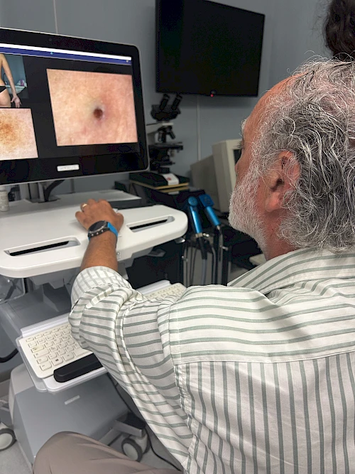 Dermatologia: Melanoma,  prevenzione, diagnosi e controllo.